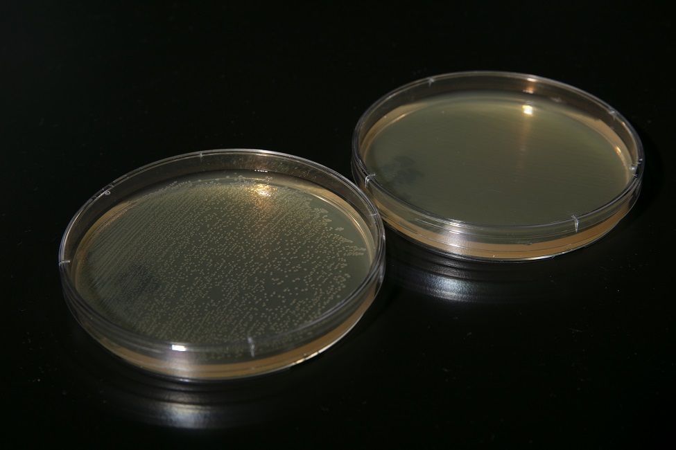 A before and after photo of the highly-contagious E-coli. The researcher tested a number of micro-organisms using this device and has shown its efficacy against pathogens. E-coli was eradicated within the device in about one minute (Photo credit: Alex Dolce)