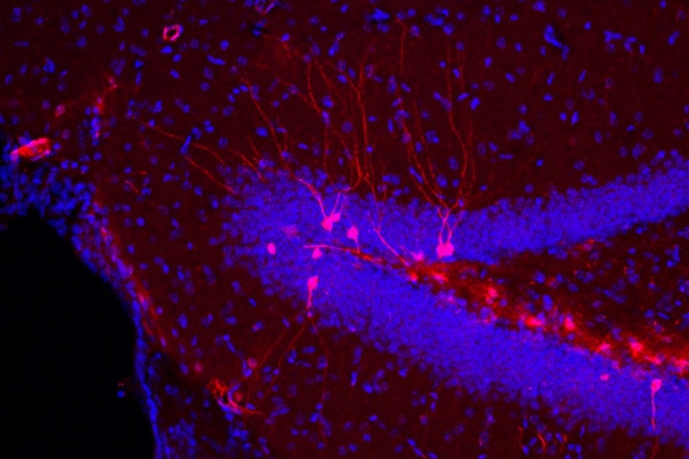 High power image of neurons (red) in the hippocampus of the mouse brain that express the IL-1 receptor (IL-1R1). Red color was generated by insertion of a fluorescent gene into the IL-1R1 gene. Both the round neuronal cell bodies and the thin, elongated dendrites that are characteristic of mature neurons can be seen. Blue color documents the presence of non-IL1R1 expressing neurons near ones that are IL-1R1 positive.