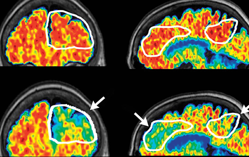 brain scan imaging in red, yellow, blue, and green