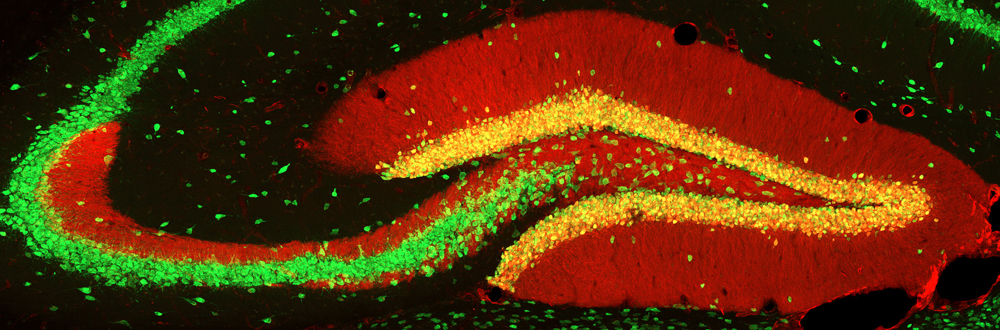 photography by Marianne Charlene Monet; brain hippocampus in red, green, yellow and black