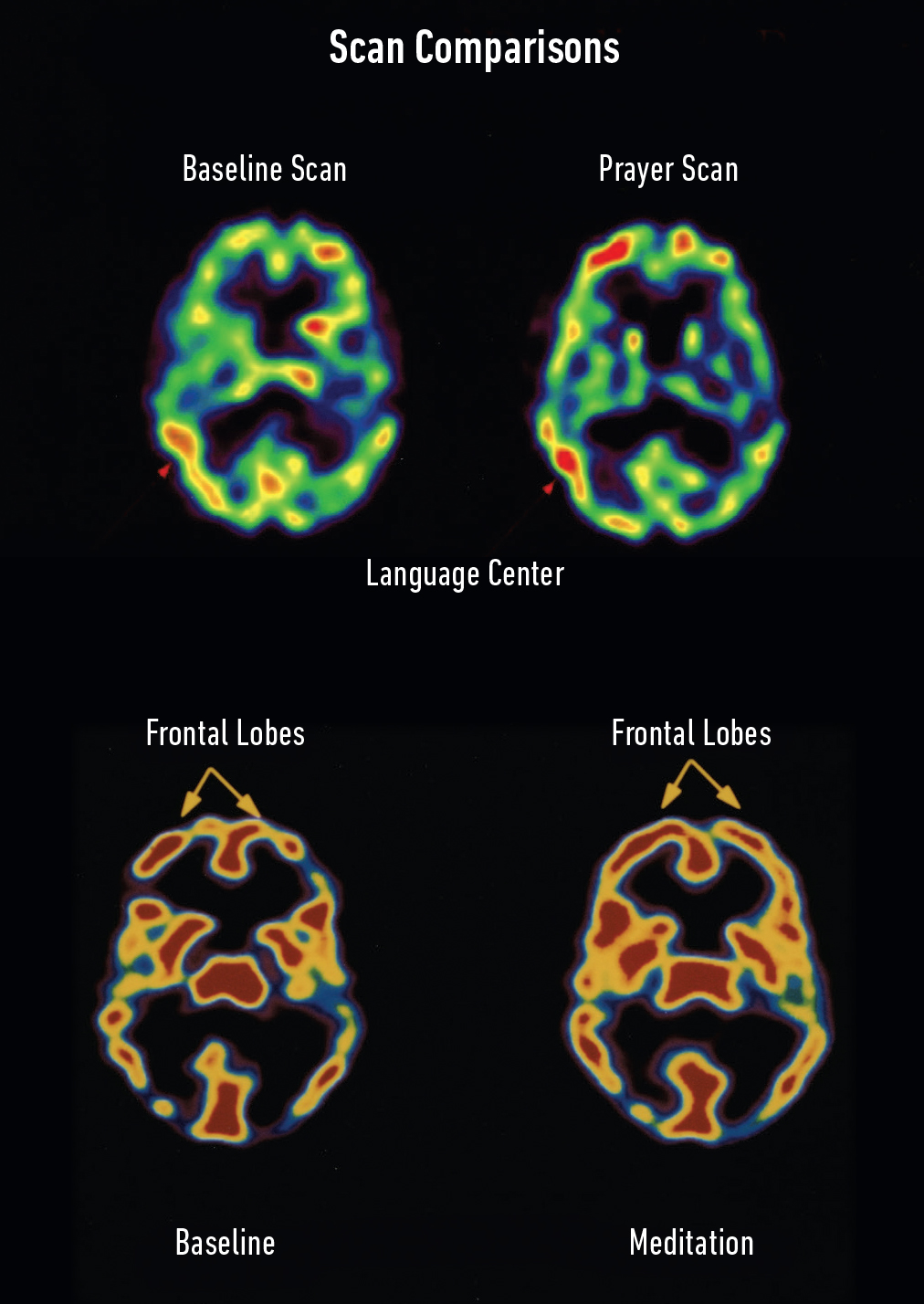 image of four brain scans