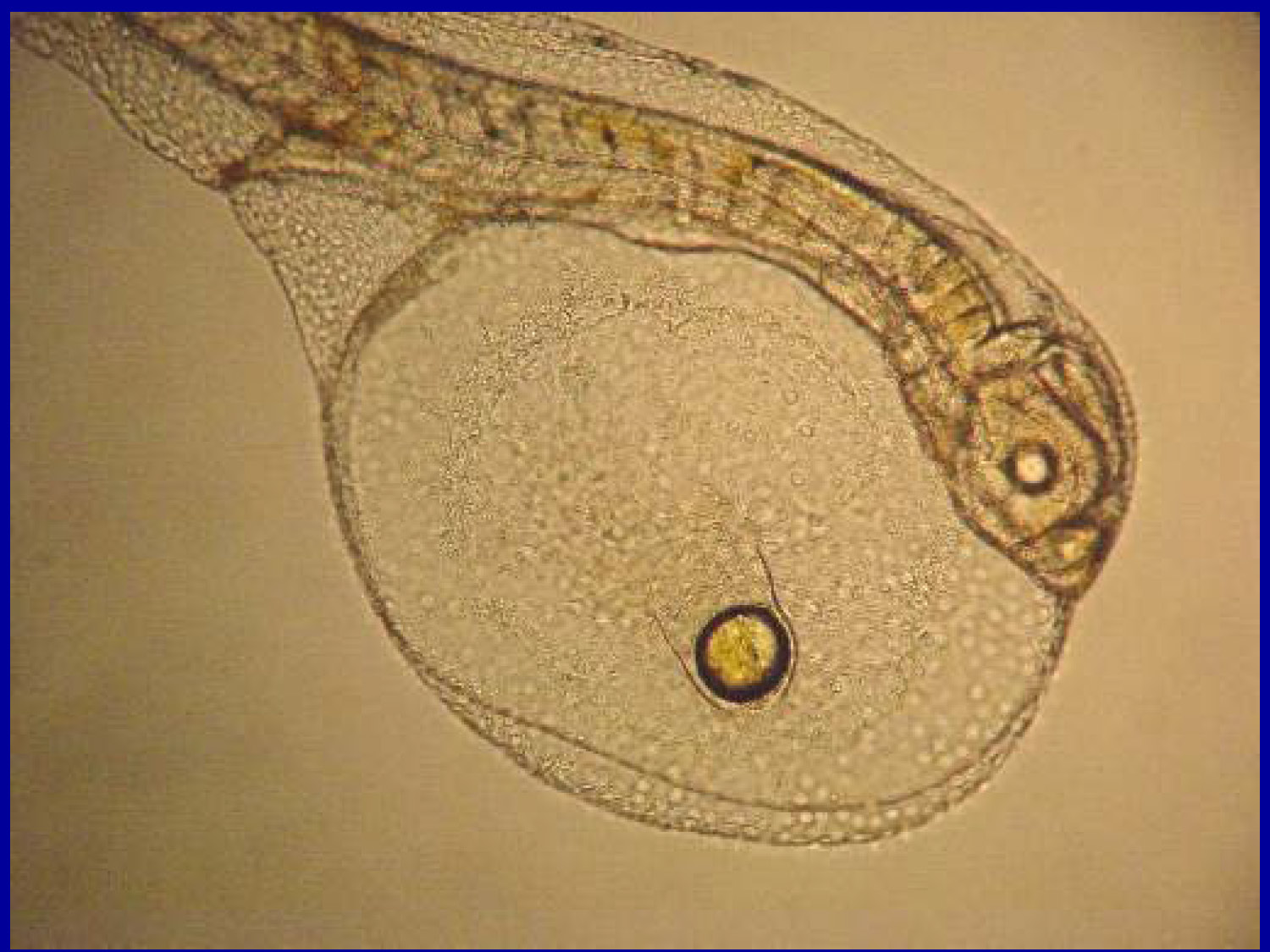 Microscopic close-up of a fish larva showing a large yolk sac and oil globule.