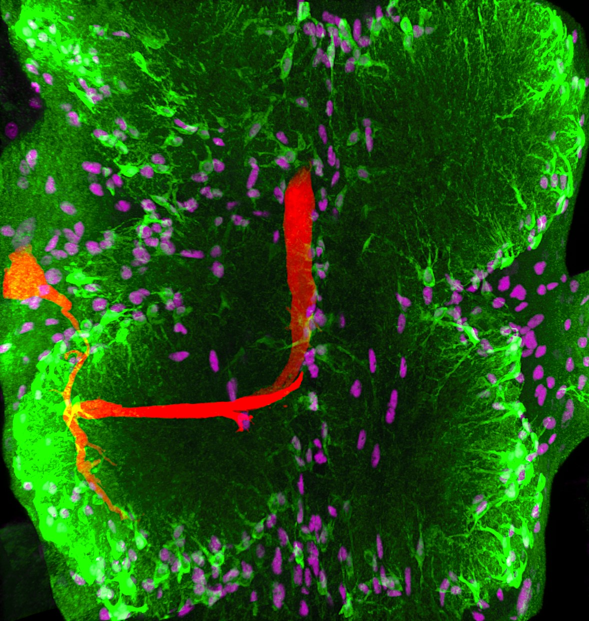 axon dendrites and astrocystes