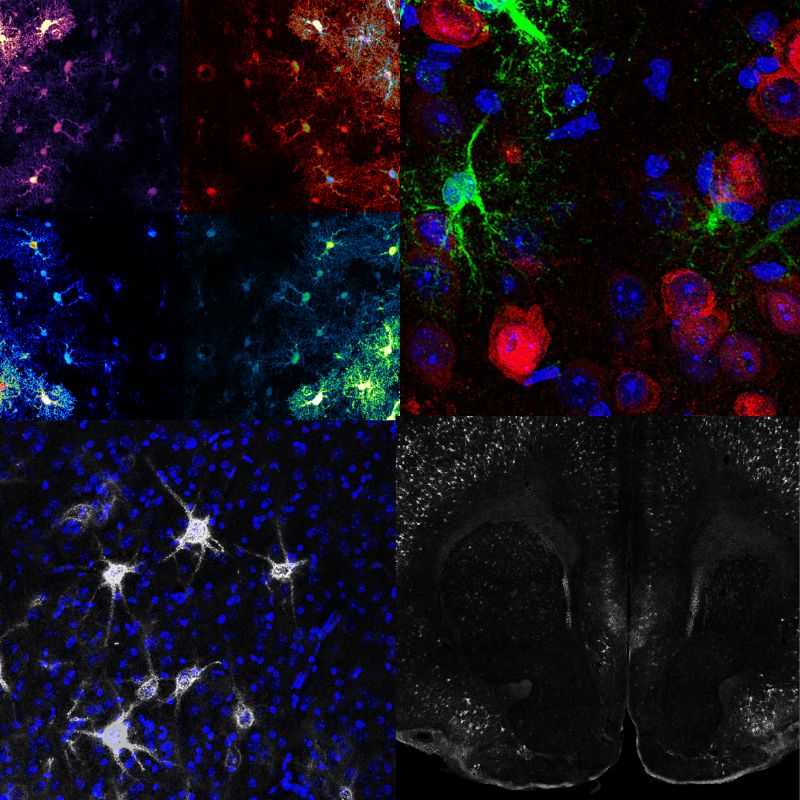 Composite microscopy image showing astrocytes, neurons, and perineuronal nets in the mouse brain, from cellular detail to whole-brain distribution.