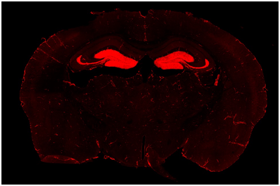 Neuroinflammation, Chronic Stress, FAU Brain Institute, Neuroscience, Psychological Disorders, Brain Circuits, Anxiety, Depression