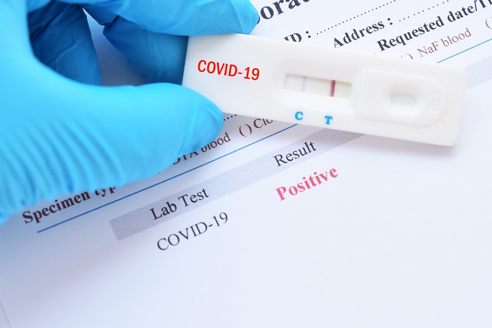 COVID-19, Tests, Algorithm, Positive, Negative, Molecular Test, Serology, Blood Test