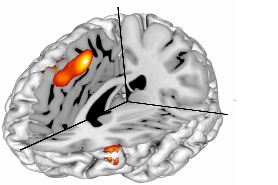 Brain, fMRI, Cognitive Behavior, Neuroscience, Calculated Surprise, Human Behavior