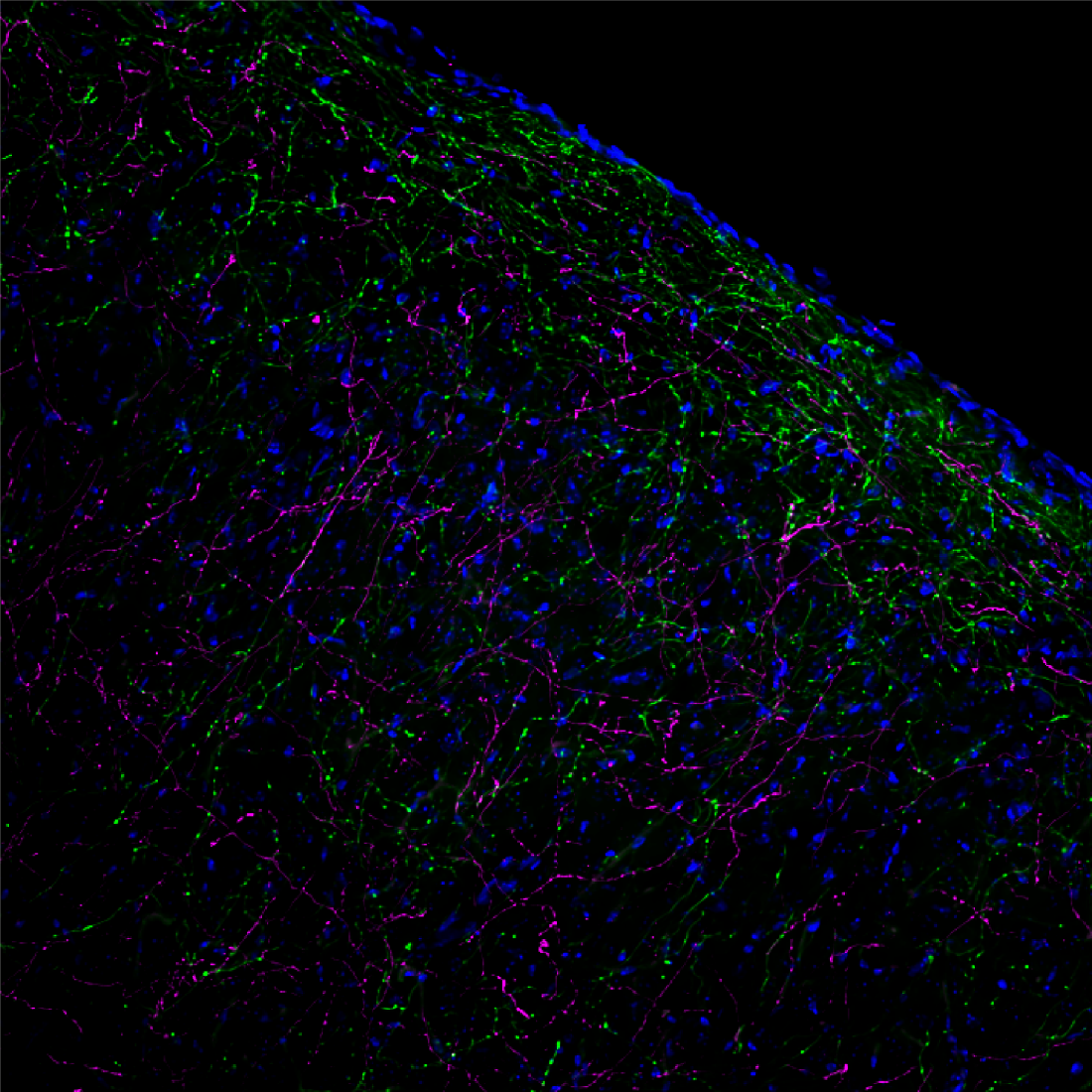  Reaching the Brain Cortex