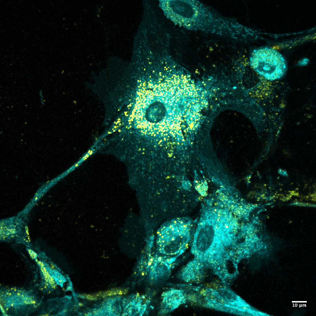 2021 photo contest Understanding Cholesterol Imbalance