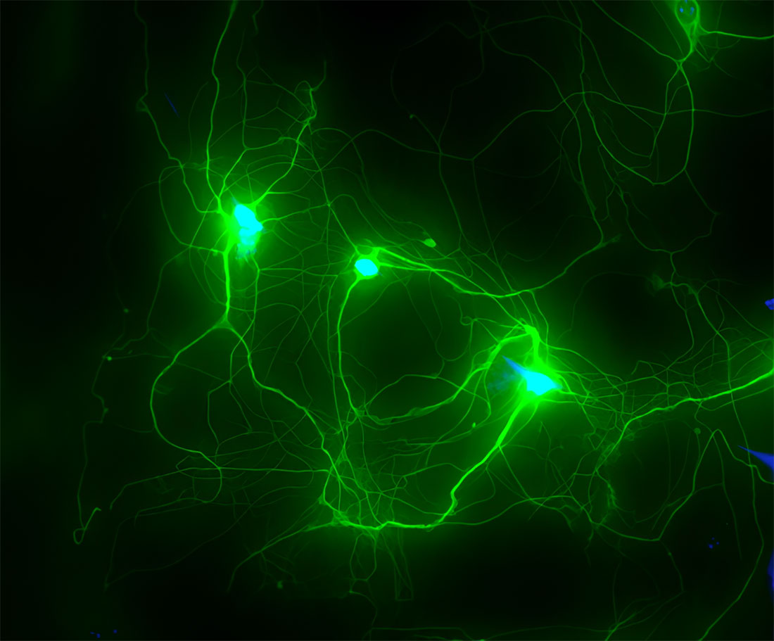 2022 photo contest round 2 Growing Human Neurons