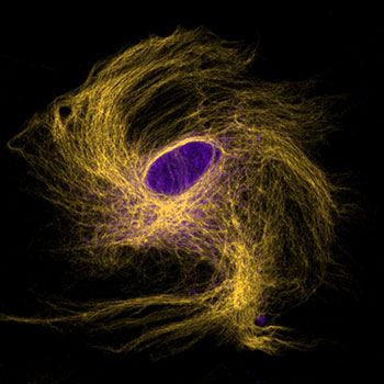 2023 photo contest Brain Cell Galaxy 