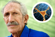 New Angles on Alzheimer's Disease