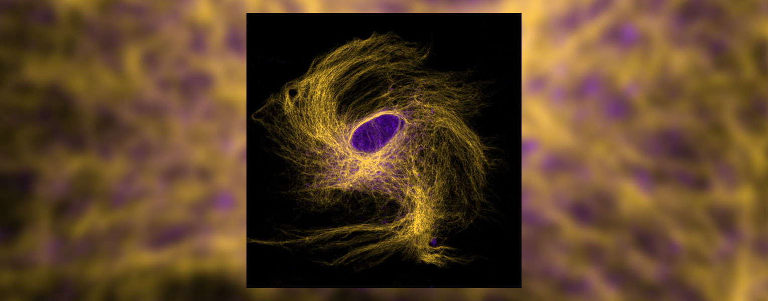 Art of Science: Brain Cell Galaxy