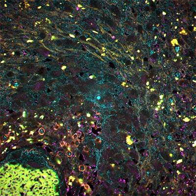 Art of Science honorable mention winner - Ugoma Onubogu, M4 and Ph.D.