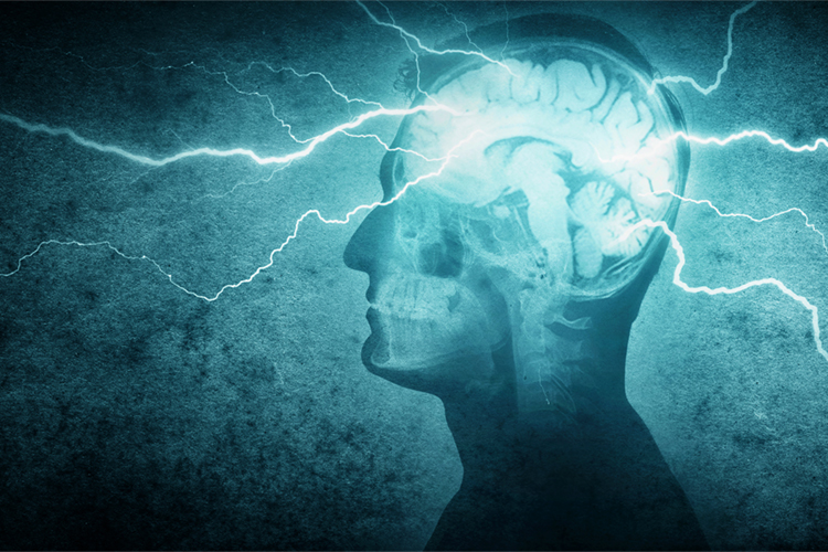 Brain Performance Supplements