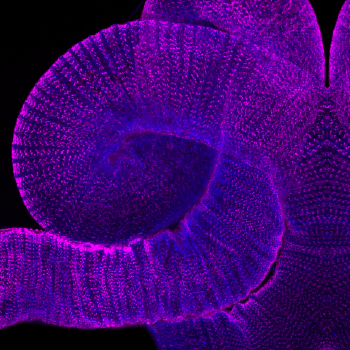 double-labeled image of a fruit fly gut in bright colors
