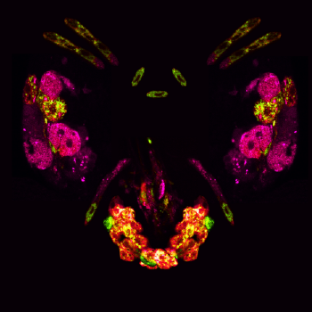 insulin producing cells of the common fruit fly in bright colors