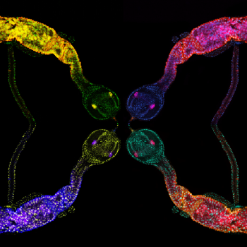 triple-labeled fruit fly stomach in bright colors