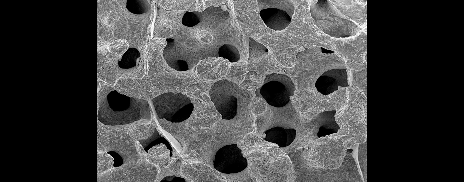 microscope (SEM) image of P. astreoides at 120x magnification depicting the morphology and microstructures of its skeleton