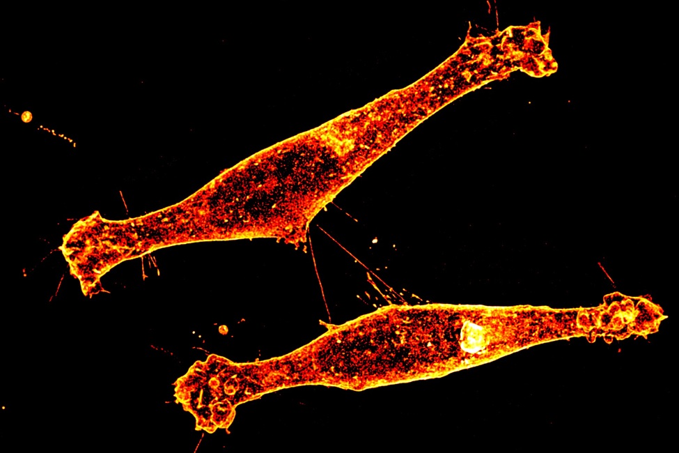 FAU Discovery of Tiny Cell ‘Tunnels' Could Slow Huntington’s Disease