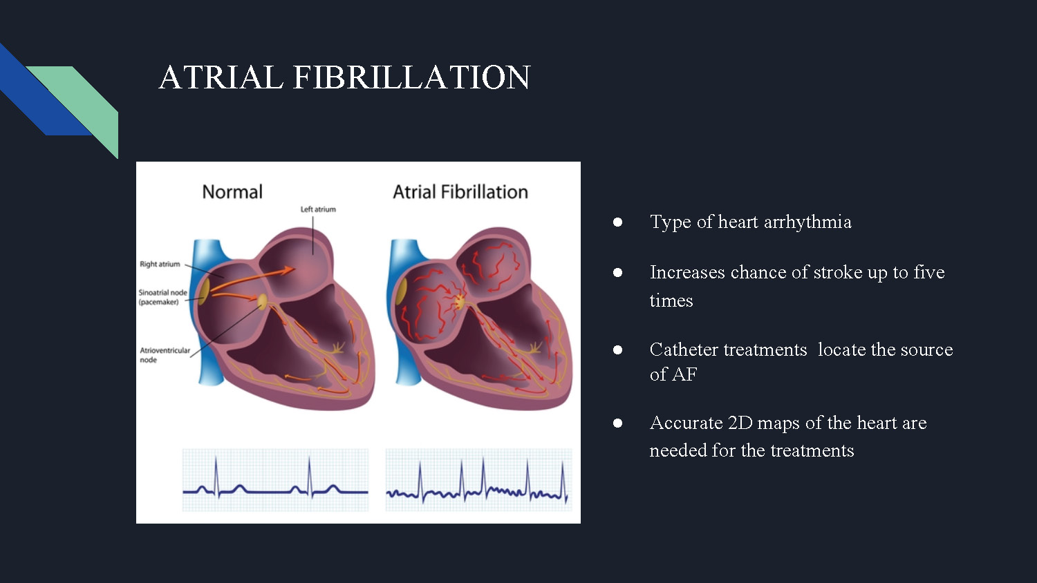 Slide 3: Atrial fibrillation background explaining heart arrhythmia, stroke risk, and need for accurate 2D heart maps