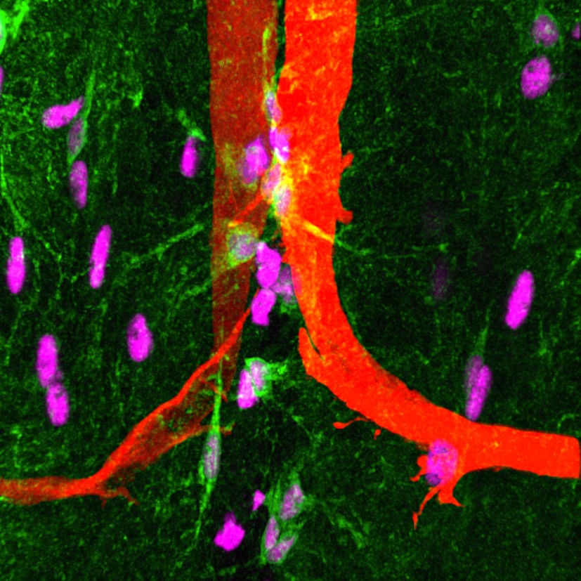 How Does the Brain Age?